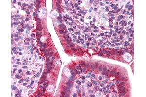 LGALS3 antibody was used for immunohistochemistry at a concentration of 4-8 ug/ml. (Galectin 3 抗体  (N-Term))