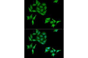 Immunofluorescence analysis of HeLa cells using CCNC antibody. (Cyclin C 抗体  (AA 1-283))