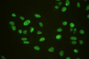 IF analysis of HAUSP/USP7 using anti-HAUSP/USP7 antibody (ABIN6719603).