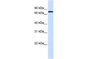 WB Suggested Anti-ZNF714 Antibody Titration:  0. (ZNF714 抗体  (N-Term))