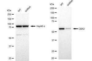 Western blotting analysis using CBX2 antibody (ABIN7798062).