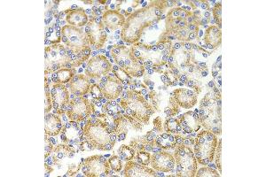 Immunohistochemistry of paraffin-embedded rat kidney using BMP15 antibody (ABIN5975746) at dilution of 1/100 (40x lens). (BMP15 抗体)