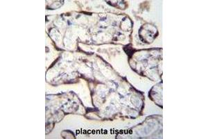 Immunohistochemistry (Paraffin-embedded Sections) (IHC (p)) image for anti-Transforming Growth Factor, beta Receptor II (70/80kDa) (TGFBR2) (AA 20-48), (N-Term) antibody (ABIN955177)