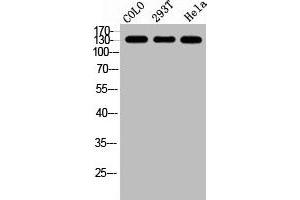 Western Blot analysis of COLO 293T HELA cells using GPR158 Polyclonal Antibody (GPR158 抗体  (N-Term))