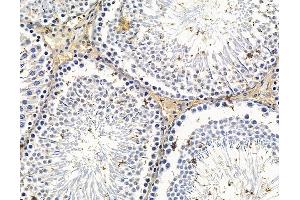 ABIN7096638 and ABIN7100703 at 1/100 staining rat testis tissue by IHC-P.