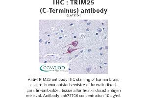 Image no. 1 for anti-Tripartite Motif Containing 25 (TRIM25) antibody (ABIN1740361) (TRIM25 抗体)