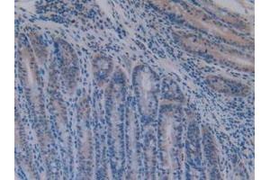 Detection of ATF1 in Mouse Intestine Tissue using Polyclonal Antibody to Activating Transcription Factor 1 (ATF1) (AFT1 抗体  (AA 3-245))