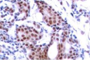 Image no. 2 for anti-ELK1, Member of ETS Oncogene Family (ELK1) (pSer383) antibody (ABIN318012) (ELK1 抗体  (pSer383))