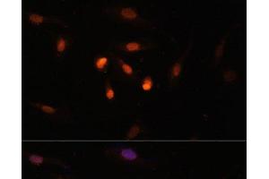 Immunofluorescence analysis of U2OS cells using KAT6A Polyclonal Antibody at dilution of 1:100. (MYST3 抗体)