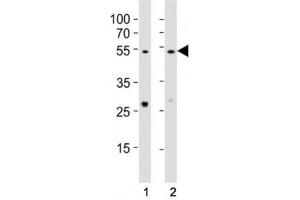 Western blot testing of EED antibody at 1:1000 dilution. (EED 抗体  (AA 269-303))