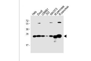 All lanes : Anti-RPL10 Antibody (N-term) at 1:4000 dilution Lane 1: Hela whole cell lysate Lane 2: Daudi whole cell lysate Lane 3: U266B1 whole cell lysate Lane 4: 293 whole cell lysate Lane 5: NIH/3T3 whole cell lysate Lane 6: Mouse pancreas lysate Lane 7: Rat pancreas lysate Lysates/proteins at 20 μg per lane. (RPL10 抗体  (N-Term))