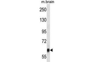VPS45 Antibody (C-term) western blot analysis in mouse brain tissue lysates (35 µg/lane). (VPS45 抗体  (C-Term))
