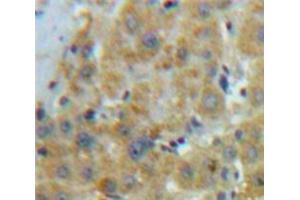 Used in DAB staining on fromalin fixed paraffin-embedded Liver tissue (APOE 抗体  (AA 19-181))