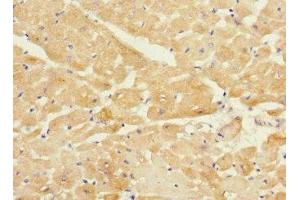 Immunohistochemistry of paraffin-embedded human heart tissue using ABIN7173550 at dilution of 1:100 (Tropomodulin 1 抗体  (AA 1-359))
