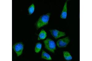 IF analysis of RPS2 using anti-RPS2 antibody (ABIN7601997).
