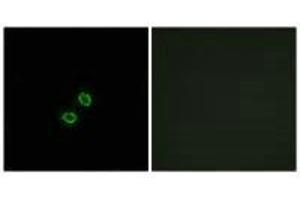 Immunofluorescence analysis of A549 cells, using KIR2DL5B antibody. (KIR2DL5B 抗体)
