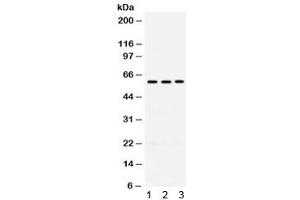 Western blot testing of human 1) A549, 2) 22RV1 and 3) U20S cell lysate with RAG2 antibody. (RAG2 抗体)