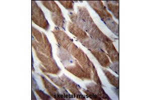 TN1 Antibody (C-term) (ABIN656749 and ABIN2845972) immunohistochemistry analysis in forlin fixed and paraffin embedded hun skeletal muscle followed by peroxidase conjugation of the secondary antibody and DAB staining. (MATN1 抗体  (C-Term))