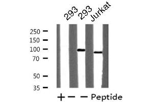 Western blot analysis of extracts from Jurkat/293 cells, using TOP1 antibody. (Topoisomerase I 抗体  (Internal Region))