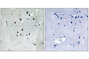 Immunohistochemistry (IHC) image for anti-Serum Response Factor (SRF) (pSer77) antibody (ABIN1847570) (SRF 抗体  (pSer77))