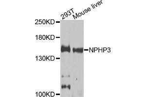 Western blot analysis of extracts of 293T and mouse liver cells, using NPHP3 antibody. (NPHP3 抗体)