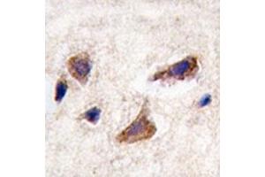 IHC analysis of FFPE human brain tissue stained with CAMKK2 antibody (CAMKK2 抗体  (AA 483-512))