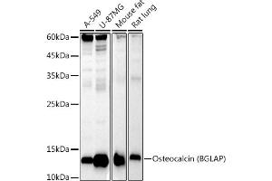Western blot analysis of extracts of various cell lines, using Osteocalcin (BGLAP) antibody (ABIN7269118) at 1:1000 dilution. (Osteocalcin 抗体)