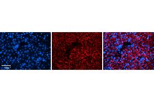Rabbit Anti-DPH1 Antibody Catalog Number: ARP51955_P050 Formalin Fixed Paraffin Embedded Tissue: Human Liver Tissue Observed Staining: Cytoplasm in hepatocytes Primary Antibody Concentration: 1:100 Other Working Concentrations: 1:600 Secondary Antibody: Donkey anti-Rabbit-Cy3 Secondary Antibody Concentration: 1:200 Magnification: 20X Exposure Time: 0. (DPH1 抗体  (N-Term))