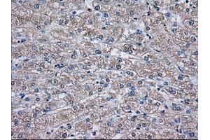 Immunohistochemical staining of paraffin-embedded Human liver tissue using anti-TBXAS1 mouse monoclonal antibody. (TBXAS1 抗体)