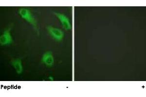 Immunofluorescence analysis of HeLa cells, using C5AR1 polyclonal antibody . (C5AR1 抗体)