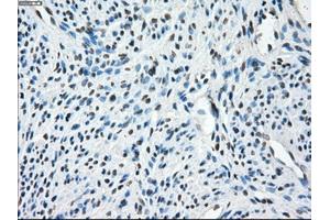 Immunohistochemical staining of paraffin-embedded Ovary tissue using anti-TMEM100mouse monoclonal antibody. (TMEM100 抗体)