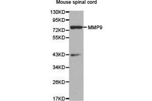 Western Blotting (WB) image for anti-Matrix Metallopeptidase 9 (Gelatinase B, 92kDa Gelatinase, 92kDa Type IV Collagenase) (MMP9) antibody (ABIN1873732) (MMP 9 抗体)