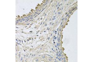 Immunohistochemistry of paraffin-embedded human prostate using HERC3 antibody at dilution of 1:100 (x40 lens). (HERC3 抗体)