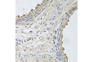 Immunohistochemistry of paraffin-embedded human prostate using HERC3 antibody at dilution of 1:100 (x40 lens).