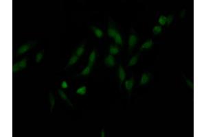 Immunofluorescence staining of Hela Cells with ABIN7127650 at 1:50, counter-stained with DAPI. (Recombinant NUP98 抗体)