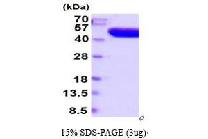 SDS-PAGE (SDS) image for Acid Phosphatase, Prostate (ACPP) (AA 33-386) (Active) protein (His tag) (ABIN7281138)