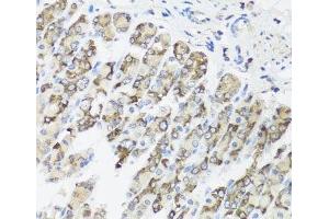 Immunohistochemistry of paraffin-embedded Mouse stomach using TIMM10B Polyclonal Antibody at dilution of 1:100 (40x lens). (TIMM10B 抗体)