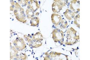 Immunohistochemistry of paraffin-embedded Human stomach using RBP2 Polyclonal Antibody at dilution of 1:100 (40x lens). (RBP2 抗体)