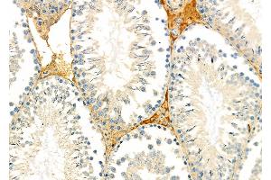 ABIN6263378 and ABIN6279009 at 1/100 staining Rat testis tissue by IHC-P.
