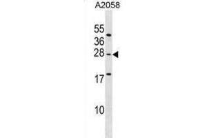 Western Blotting (WB) image for anti-Ependymin Related Protein 1 (Zebrafish) (EPDR1) antibody (ABIN2999325) (EPDR1 抗体)
