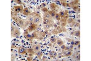 NEU2 antibody immunohistochemistry analysis in formalin fixed and paraffin embedded human liver tissue. (NEU2 抗体  (AA 23-50))