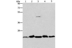 Western Blot analysis of Mouse spleen and Human fetal liver tissue, hela cell and Mouse testis tissue, A431 cell using THOC7 Polyclonal Antibody at dilution of 1:500