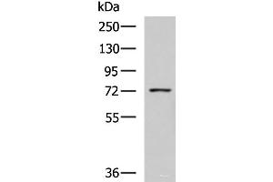 Western blot analysis of K562 cell lysate using GUSB Polyclonal Antibody at dilution of 1:800 (Glucuronidase beta 抗体)
