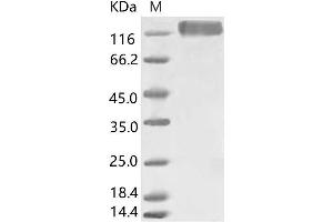 HCoV-229E S1 Protein protein (His tag,ECD)