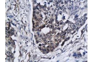 Immunohistochemistry (Paraffin-embedded Sections) (IHC (p)) image for anti-Sirtuin 3 (SIRT3) (AA 201-300) antibody (ABIN762506)