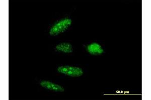 Immunofluorescence of purified MaxPab antibody to RTCD1 on HeLa cell. (RTCD1 抗体  (AA 1-366))