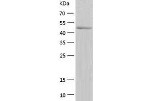 Western Blotting (WB) image for Tyrosyl-tRNA Synthetase 2, Mitochondrial (YARS2) (AA 17-477) protein (His tag) (ABIN7289482) (YARS2 Protein (AA 17-477) (His tag))