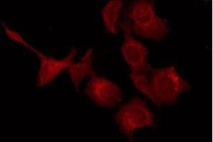 ABIN6277390 staining HepG2 by IF/ICC. (KISS1 抗体  (Internal Region))
