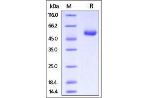 Biotinylated Human CTLA-4, Fc tag on SDS-PAGE under reducing (R) condition. (CTLA4 Protein (AA 37-162) (Fc Tag,AVI tag,Biotin))