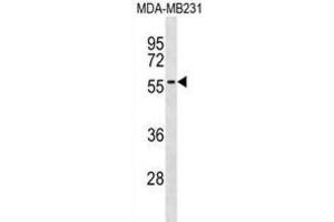 Western Blotting (WB) image for anti-A Kinase (PRKA) Anchor Protein 5 (AKAP5) antibody (ABIN3000745) (AKAP5 抗体)